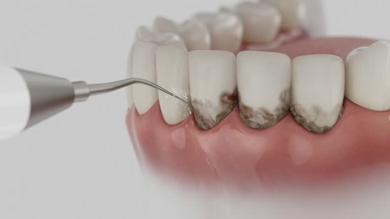 Reliable Dental contractor in London, OH by Dentist Open Now